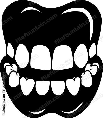Open Teeth