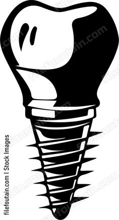 Dental Implant