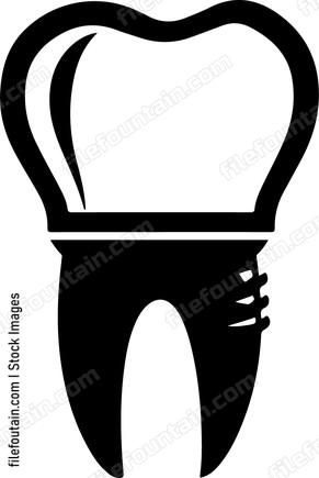 Dental Implant Dentist