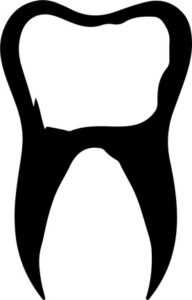 Tooth with cavity
